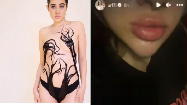 urfi-javed-got-lip-fillers
