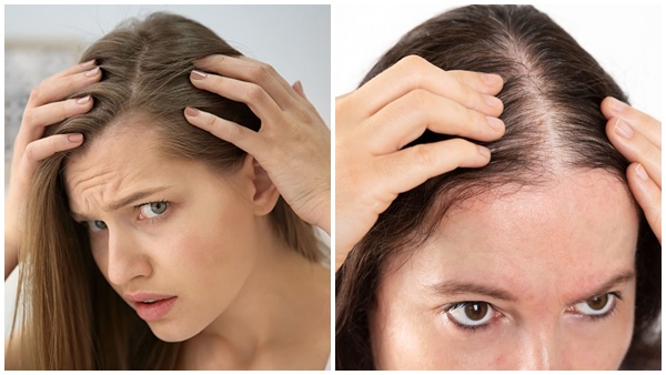 Fast Hair Growth