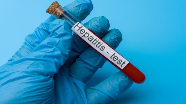 Hepatitis Epidemic Diseases 