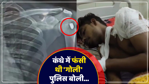 bullet-was-stuck-in-young-mans-shoulder-police-returned-it-in-ghazipur-up