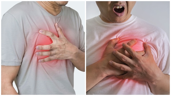 heart attack