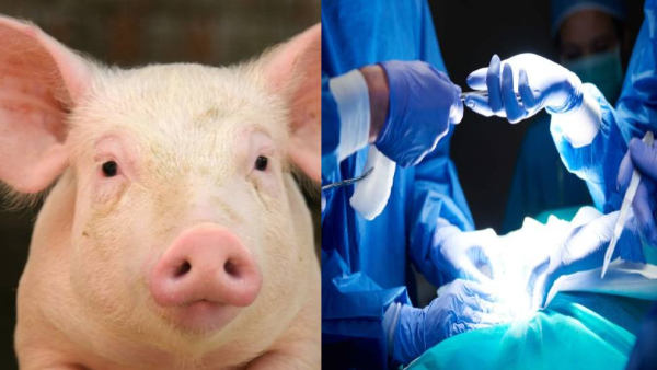 pigs heart in humans again will become an option for organ transplant in future?