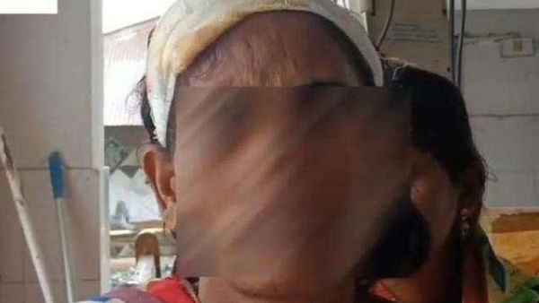 Bihar Patna Dalit woman News