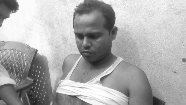 father and son died due to fire broke out in candle factory in kannauj of uttar pradesh 
