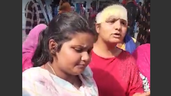 Both legs of 18 year old boy went missing from the post mortem house in kanpur 