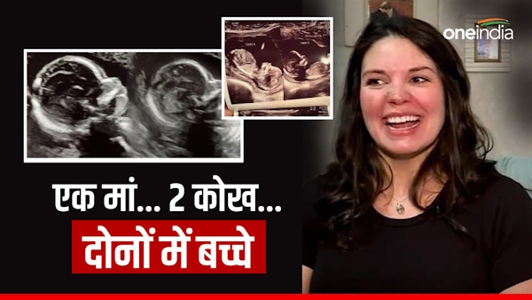 american woman Kelsey Hatcher born with two uteruses and is now pregnant in both 