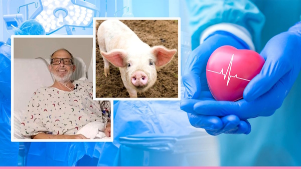 second person who received a genetically modified pigs heart transplant died in america