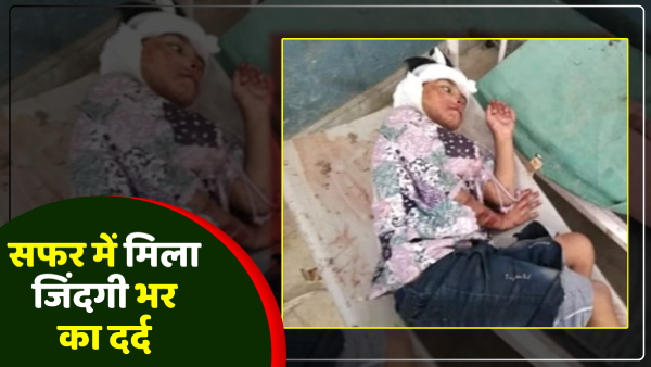 up-news-innocent-girl-got-lifelong-pain-during-the-journey