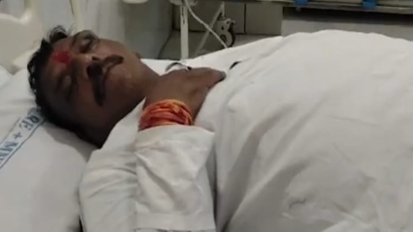 Antar Singh Darbar, contesting elections from Mhow accident while taking selfie admitted to hospital