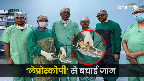 bina operation aur cheera lagaye doctors ne nikali mareez k shareer se goli, Bihar News In Hindi
