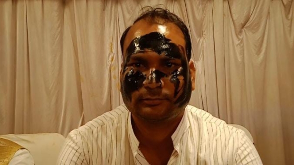Congress leader blackened his face before Phool Singh Baraiya, will go to Bhopal to convince Bhander MLA