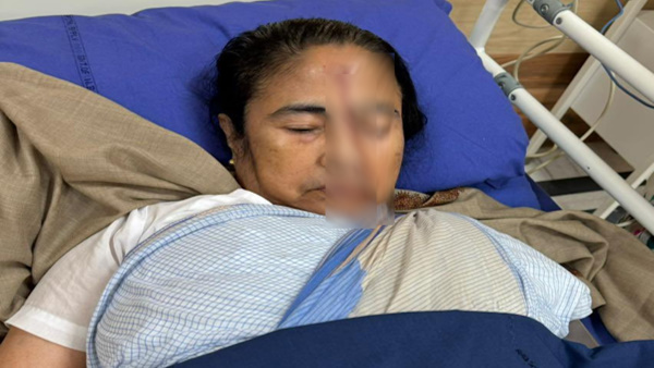 CM Mamata Banerjee Accident
