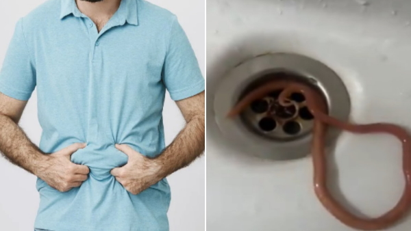 Man vomit live worm Man vomit live worm