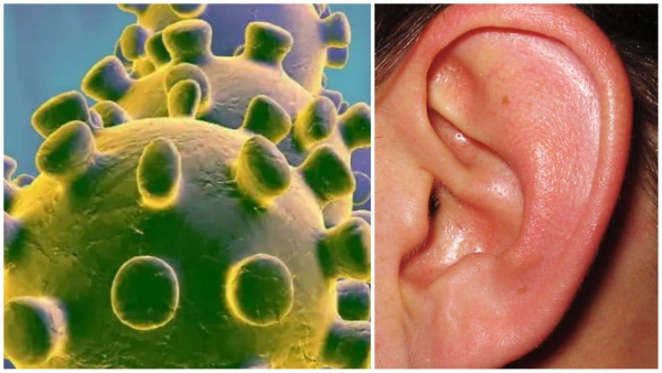 Change in weather virus attack on ears eight children became victims of deafness due to mumps
