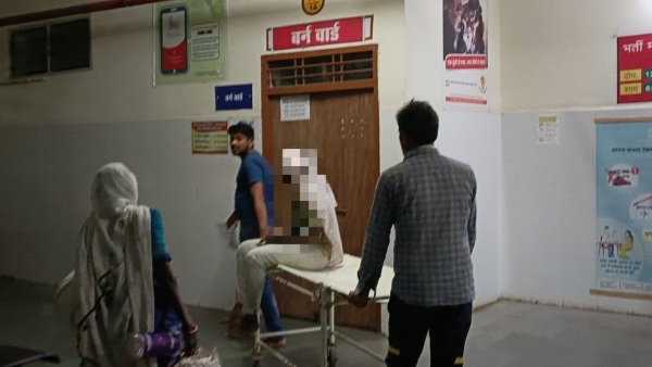 Betul lover poured petrol on a girl in a live-in relationship the injured was referred to Bhopal Betul lover poured petrol on a girl in a live-in relationship the injured was referred to Bhopal