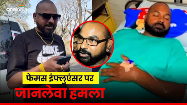 Bhupendra Jogi Brutally Attacked