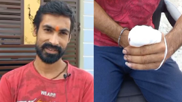 Durgesh Pandey cuts fingre