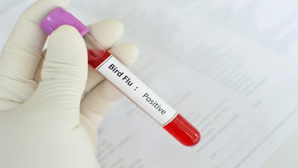 H9N2 bird flu WHO told everything