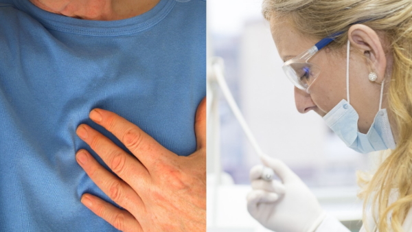 Angioplasty