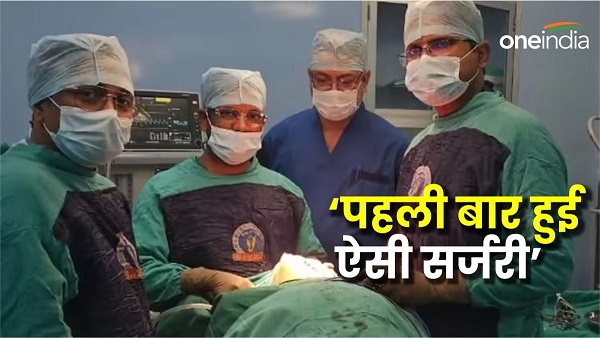 first time in Bihar Transplantation of this body part took place expert said it created medical history