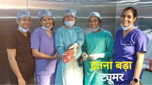 Tumor removed from stomach Indore News