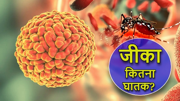 Zika Virus Case 2024