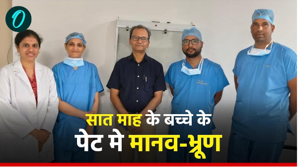 human fetus growing stomach seven-month-old child doctors gave new life surprised to hear reason human fetus growing stomach seven-month-old child doctors gave new life surprised to hear reason