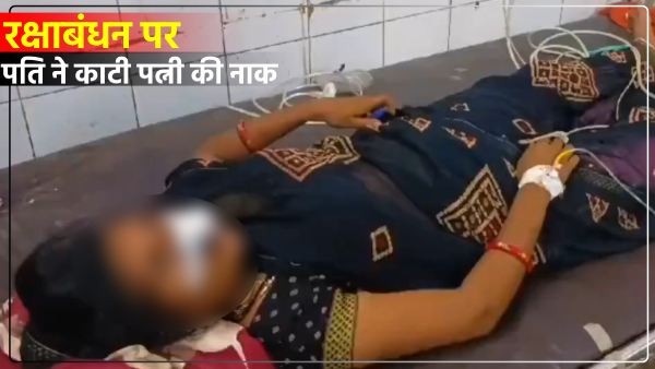 hardoi-news-husband-cuts-wifes-nose-she-wanted-to-go-to-her-mothers-house-on-rakshabandhan