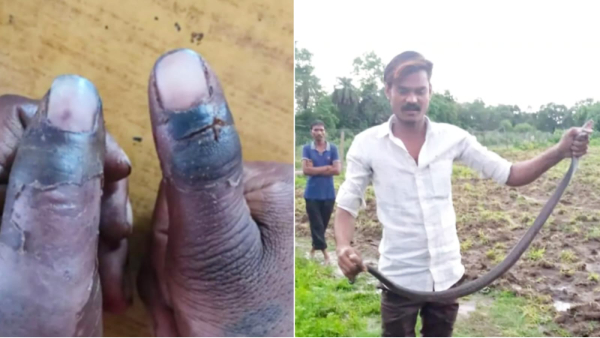 Sagar Black Cobra Poisonous Human