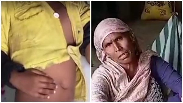 Guna Step mother Razia Bano punishes 5 year old son for urinating in bed