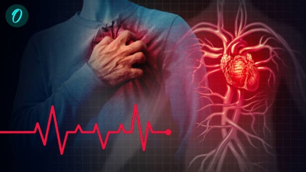 cardiac arrest