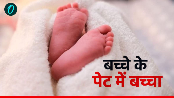 Pregnancy In Stomach Of Four Day Old Girl