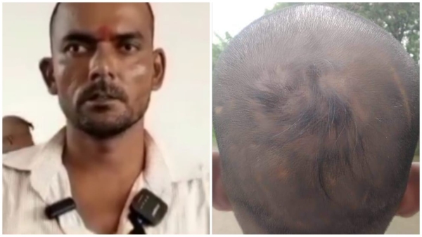 Police uprooted youth s hair in Mauganj people from Brahmin community reached SP office