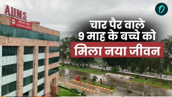 four-legged 9-month-old baby got new life AIIMS Rishikesh know how doctors did this miracle