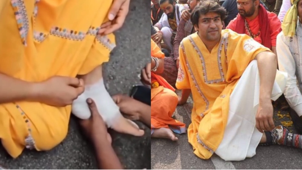 Dhirendra Shastri has blisters on his feet Dhirendra Shastri has blisters on his feet