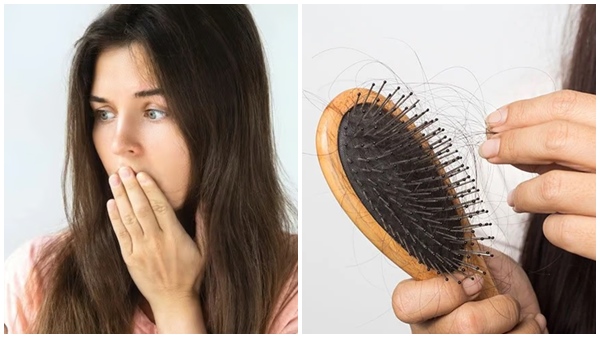 Hairfall