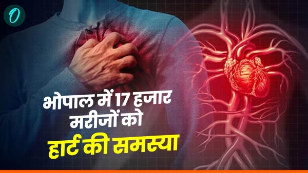 Heart related problems are increasing doctors warned 57 thousand people got chest pain in 2 months Heart related problems are increasing doctors warned 57 thousand people got chest pain in 2 months