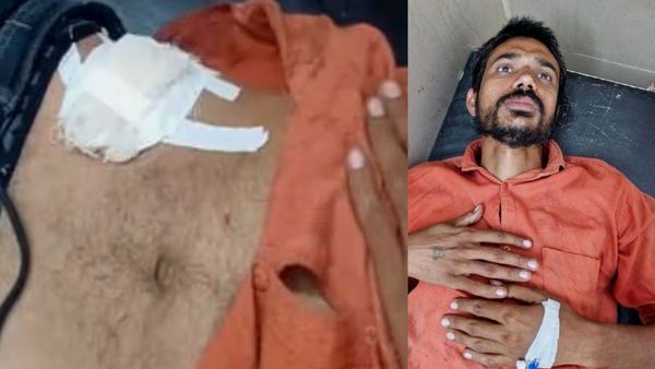 Man Attempts Self-Surgery In Vrindavan