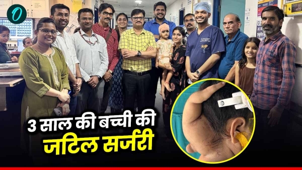 Complex surgery of 3-year-old girl in AIIMS parasitic twin removed Ashoknagar girl got a new life Complex surgery of 3-year-old girl in AIIMS parasitic twin removed Ashoknagar girl got a new life