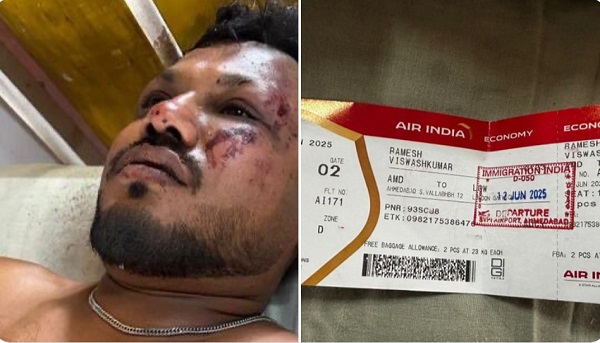 Ahmedabad Plane Crash Vishwash Kumar Ramesh