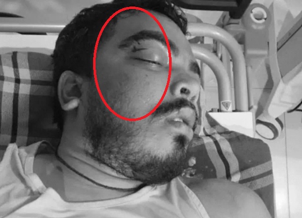 Prince Yadav Postmortem Report