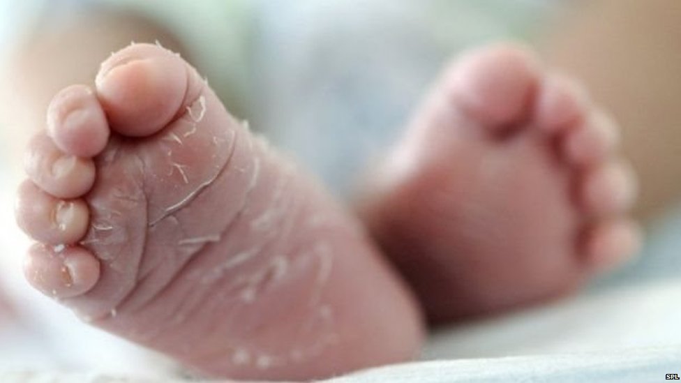 मैक्स अस्पताल, दो बच्चों की मौत, शालीमार बाग़