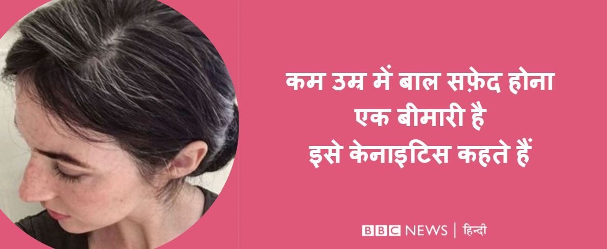सफेद बाल