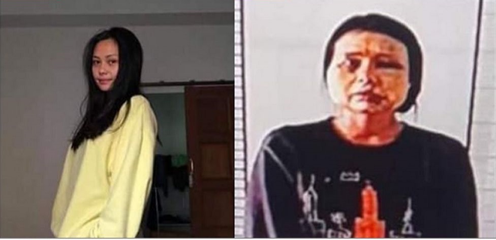 इस साल की शुरुआत में सेना ने हिरासत में रखी गई एक महिला की तस्वीर प्रसारित की थी. उनके चेहरे पर इतनी चोट थी कि उन्हें पहचानना संभव नहीं था.