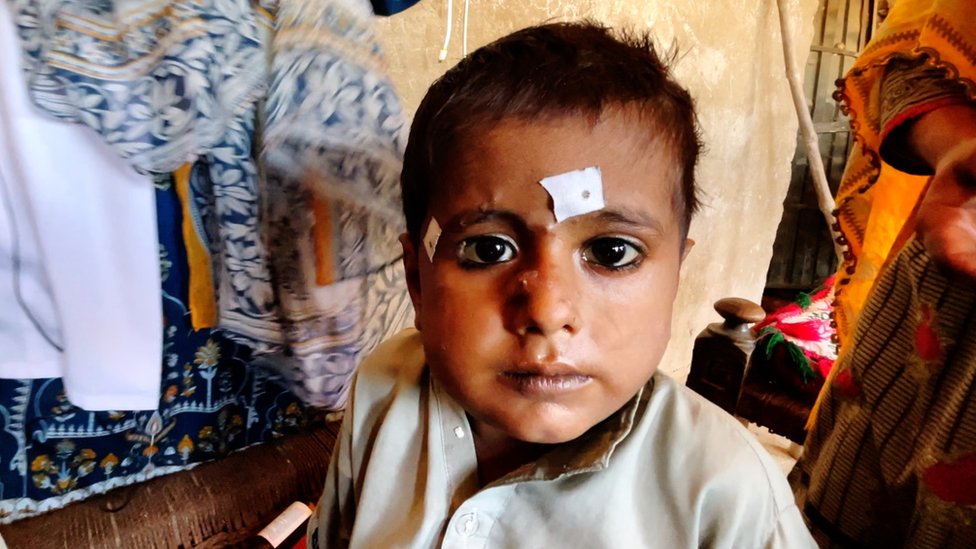 3 साल का गुलबहार दूषित पानी के कारण बीमार हो गया है.