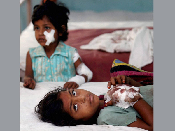 Injured in the communal riots