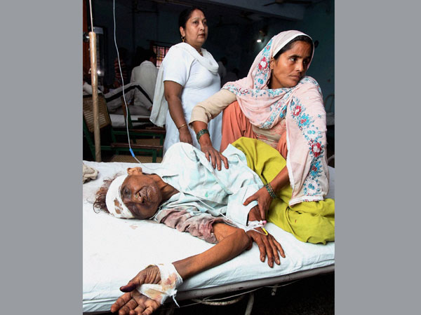 Injured in the communal riots