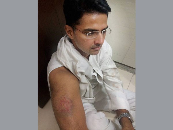 Sachin Pilot injured in clash