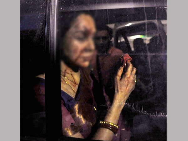 Hema Malini hospitalised after accident