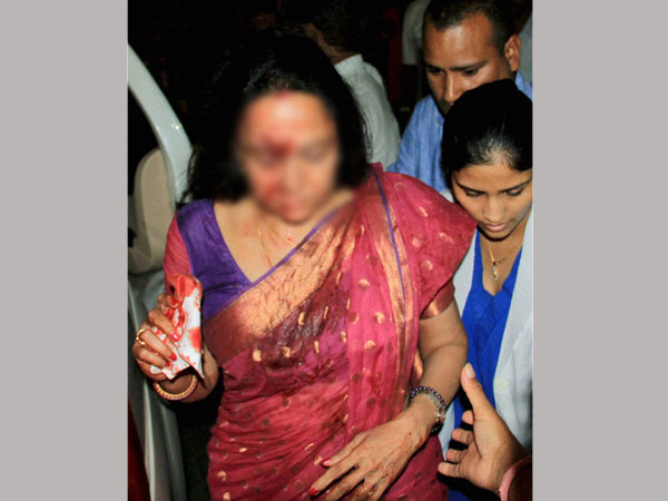 Hema Malini has head injuries